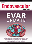 EVAR For Ruptured Abdominal Aortic Aneurysms - Endovascular Today