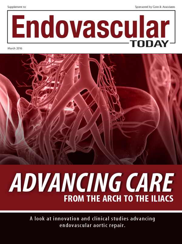 Chronic Type B Dissection: Rules Of Engagement For TEVAR - Endovascular ...