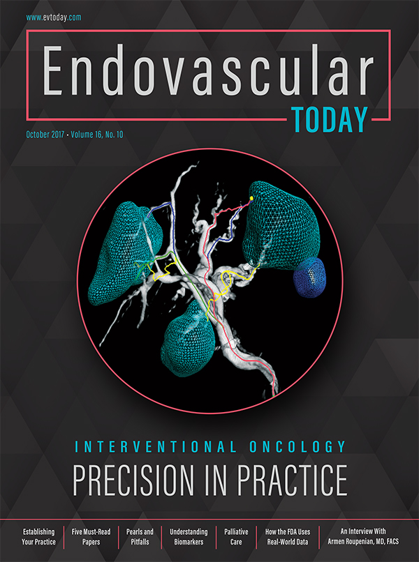 Interventional Oncology: Precision In Practice - Endovascular Today