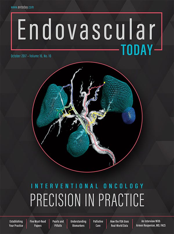 Interventional Oncology Precision In Practice Endovascular Today